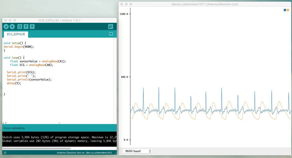 Time period between 2 peaks of 2 different graphs - Sensors - Arduino Forum