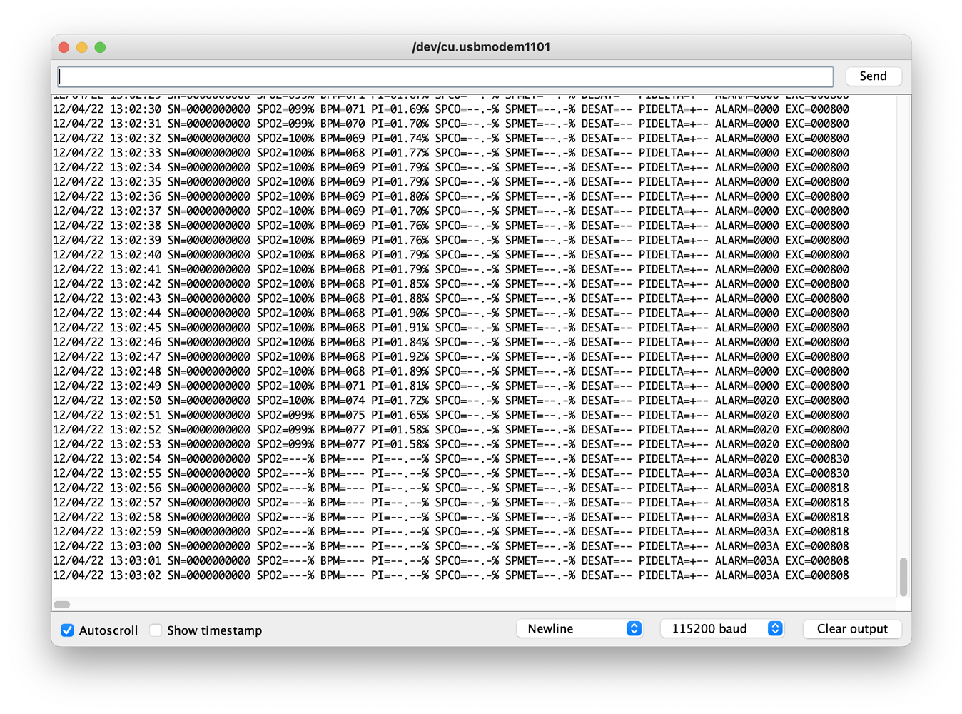 Reading RS232 Serial Data from a Pulse Ox Project Guidance Arduino