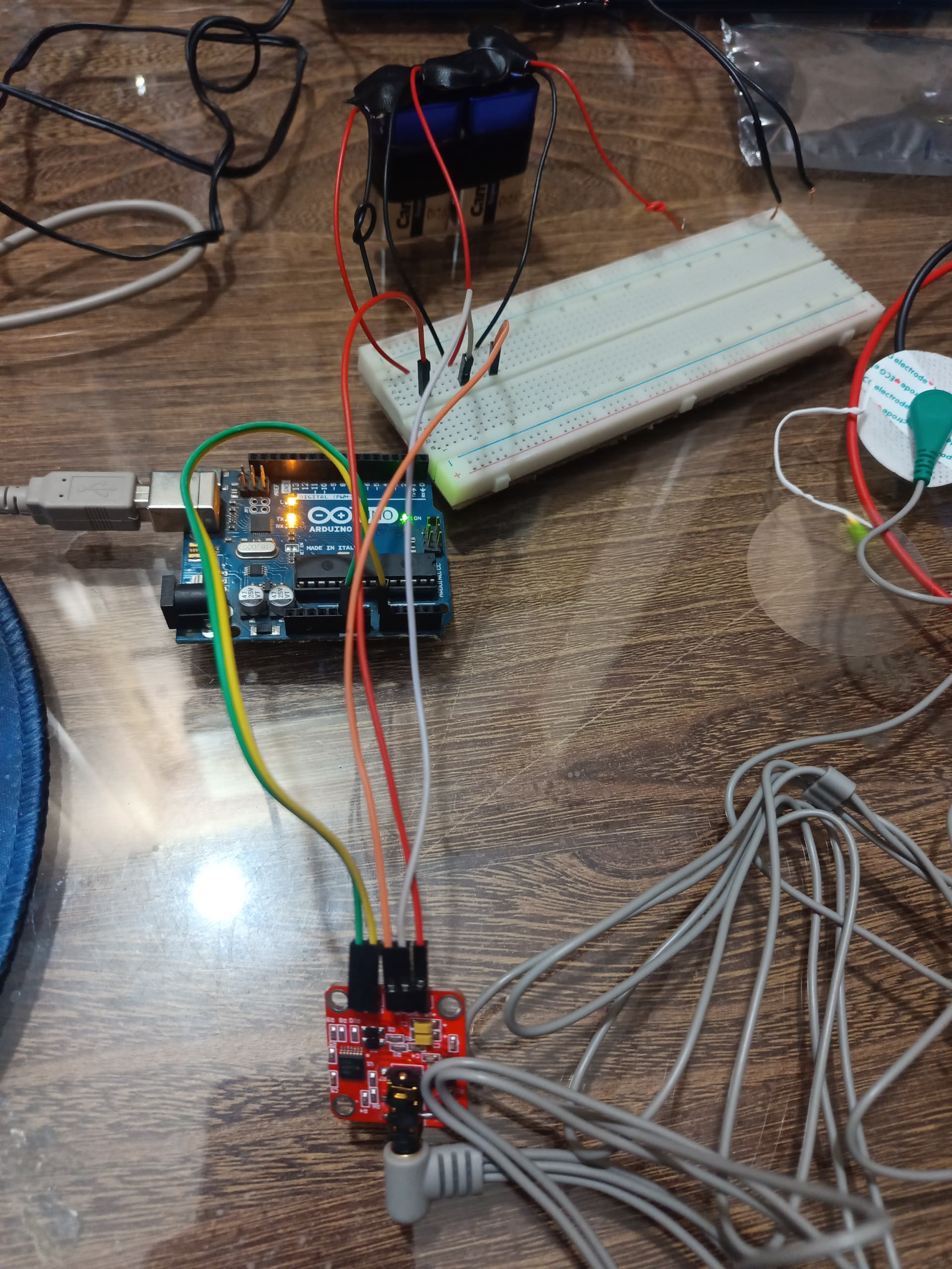 EMG sensor values fluctuate from min to max - Sensors - Arduino Forum