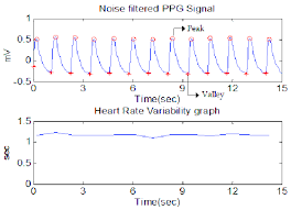 How do i make my arduino detect peak to peak - General Guidance ...