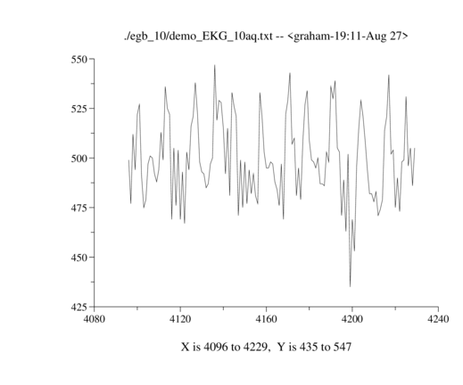 demo_EKG_10aq.png