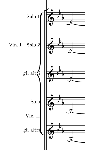 Slice 1.png