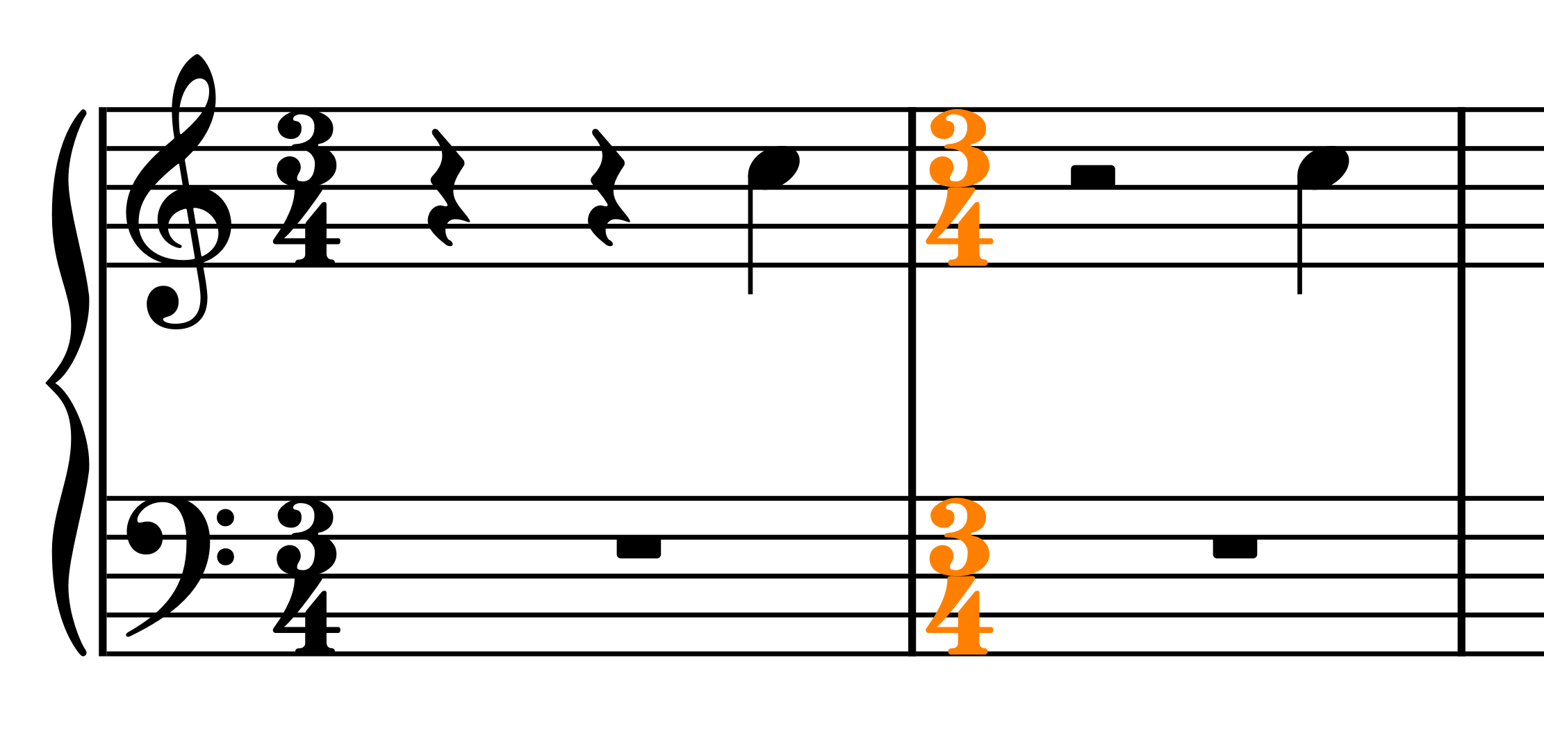 incorrect-rest-in-3-4-dorico-steinberg-forums