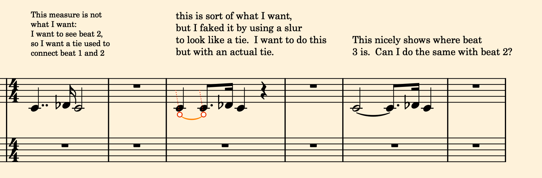 その他 INTERCEPTION KNOWS Acutic Notes INTERCEPTION KNOWS / AcuticNotes