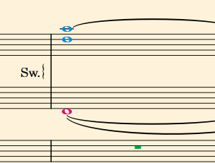 organBraces